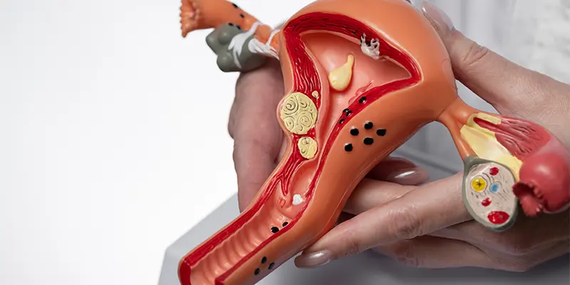 Cáncer cervicouterino